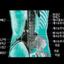 허리 요통 요염좌 요척굴 침구치료 이미지