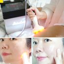 Botem(보탬) | 보탬큐브 프로페셔널 고주파마사지기 피부관리실의 다이어트&amp;피부탄력관리기 사용후기