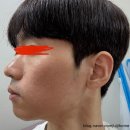 스타S피부과의원 | 청주 ‘S' 의원 방문기 9편｜지루성 피부염 피부과 4회차 시술 후 피부 상태 후기(feat.항생제)