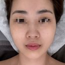서면 슈퍼네일 | 『서면경락마사지』 친절하고 꼼꼼한 비대칭 윤곽케어 후기 전포에스테틱 “가인미가 부산서면점”
