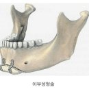 이*부 Daum카페