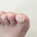 파리바게뜨평내마을점 | 남양주 라파에스테틱에서 문제성발톱 걱정 끝! 호평동네일아트