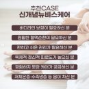 뉴비스 이미지