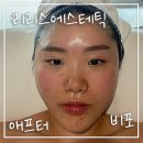 리리스 에스테틱 | 역삼동 피부관리 리리스 에스테틱에서 탄력관리 했어요