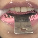 서울윌치과 이미지