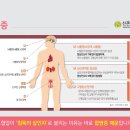 고혈압의 합병증 이미지