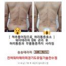 송송테라피 이미지