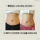 미엔지 | 오산 미앤지 얼굴 윤곽관리, 승모근 관리 후기