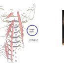 두장근(longus capitis)와 경장근(longus colli)의 구조와 기능 이미지