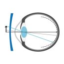 아이디안경 이미지