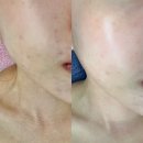 자연피부관리실 이미지