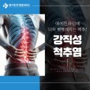 명지튼튼정형외과의원 | 명지정형외과 에어컨 바람에 더욱 뻣뻣해지는 척추! 강직성척추염