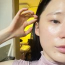 미앤터치의원 | 대전윤곽관리 대전비대칭관리 추천 <손앤미뷰티스킨>