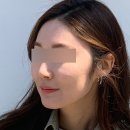 자이안피부과의원 | [서울/중랑] 다시 찾은 태릉입구 자이안피부과 레이저후기