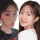 "우리엄마도 성형하고 온지 몰라요" 성형만 7번째, 그만 좀 하라는 성형, 저도 그만하고 싶어요!! 눈앞...