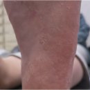 크림 | 발 각질 크림 내돈내산 후기 결국 이렇게 됨