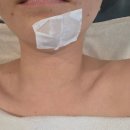 수가에스테틱 | 여름철 모공과 흉터가 고민이라면? 마곡모공관리 림에스테틱 후기