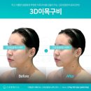 힐링#기공경락연구소 | [광주경락] 얼굴 소멸 직전 광주에스테틱 고운빛깔 에스테틱 광주점 웨딩케어 솔직 찐후기