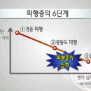 하지 통증(다리 통증) 원인과 파행증 구분 이미지