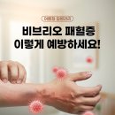 비브리오 패혈증 이렇게 예방하세요! 🚨 이미지
