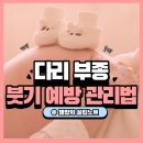 뒷발이삼계탕 | 임신 중 다리 붓기 원인과 부종 완화법｜혈액순환 돕는 식단과 생활 습관