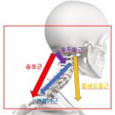 목디스크 아닌데 목통증,어깨통증,손저림에 효과적인 스트레칭