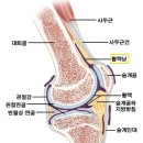 무릎의 활액낭염 이미지