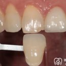 메디포레치과의원 이미지