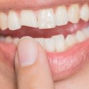 탑티어치과의원 이미지