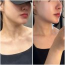 약손명가 바디 케어 맞춤관리E, 약손명가 사당점 얼굴 경락 효과 내돈내산 재등록 후기