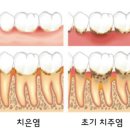 이로움 연 이미지