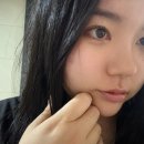 케어온 | 첨단 피부관리 아비에｜마이크로젯 천방 케어 받고 온 후기