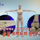 골다공증의 공포에서 벗어나라! 이미지