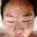 상인동 피부관리 아라우에스테틱 알라딘필링 찐만족 후기
