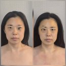 대구 피부관리 대명동 리안 스킨&바디 리프팅 후기