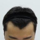압구정맘모스헤어라인의원 이미지