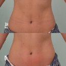 (주)에이랩코리아 | 부천 셀포랩 니즈점, 1회 관리로 체지방율 1kg 감소한 후기
