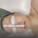 골프앤바디핏 | 대구 피부관리 킴그린스킨앤바디 상인점 페이스핏톡스 후기