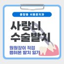 향기로운서울훈치과의원 | 부분 매복 사랑니 수술 발치... 직접 겪어보았습니다. 환자시점