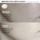 비피엔씨 이미지
