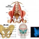 [일반] 요즘 길에서 절뚝이들 많이 보이는데... 이미지