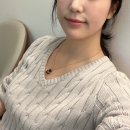 신논현역성형외과 튠페이스 튠라이너 턱라인 이중턱개선 효과
