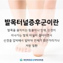 봉천동 정형외과 발목터널증후군 자가진단법은? 이미지