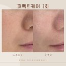 미더베스트마곡점 | 마곡피부관리 (+미더베스트 마곡점) 찐 후기~!