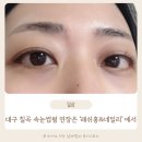 대구 칠곡 속눈썹 펌 연장 태전동 래쉬홍 후기