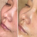 힐링 피부샵 | 김포 장기역 피부샵 오감케어 힐링뷰티 오감스킨 모공관리 후기