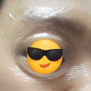 온메디케어주식회사 | 라섹 전 준비(수술 후 수정+)