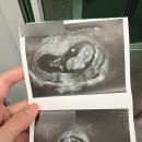 서리풀성모여성의원 이미지