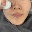 노송동-05(노송동주민센터) | [뷰티] 속부터 차오르는 수분! 물방울리프팅 전문, 로더에스테틱