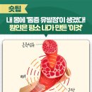 내 몸에 '통증 유발점'이 생겼다! 원인은 평소 내가 만든 '이것' 이미지